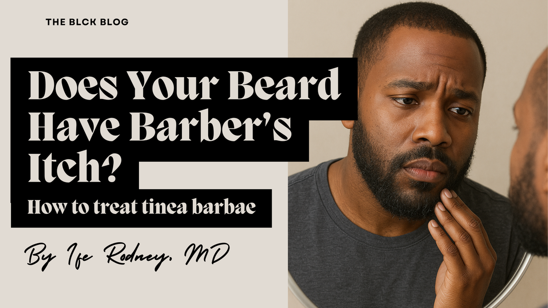 Beard Got Barber's Itch? Here's How To Treat Tinea Barbae