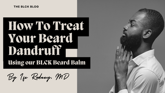 How To Treat Beard Dandruff [With Our Beard Balm]