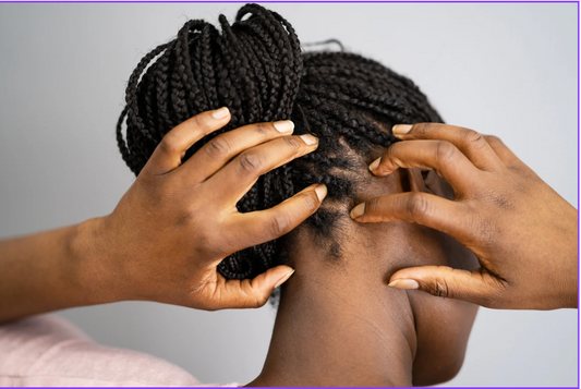 How To Maintain Sisterlocks With A Scalp Condition